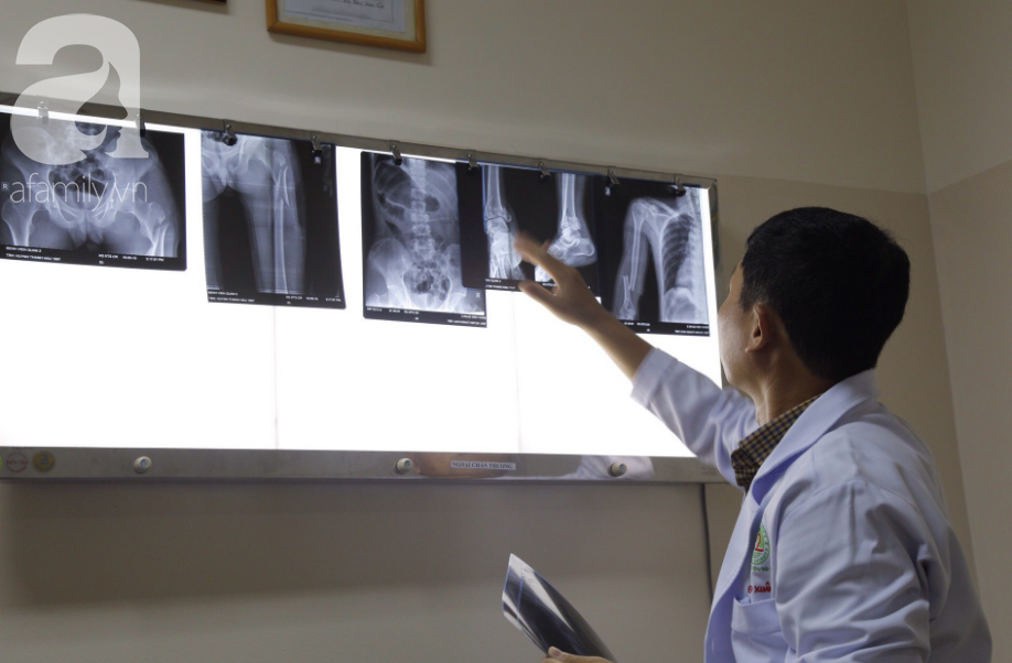 TP.HCM: Bị gia đình ngăn... lấy chồng, thanh niên 22 tuổi nhảy từ lầu 4 chung cư xuống đất chấn thương nặng - Ảnh 3.