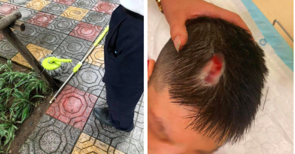 Hà Nội: Chổi lau nhà rơi từ tầng 5 chung cư cao cấp khiến bé trai vỡ đầu phải nhập viện