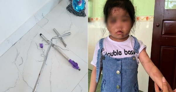 Prosecution of the case that the aunt used an iron broom to beat the 4-year-old grandchild to the hospital because he was “lazy to eat”
