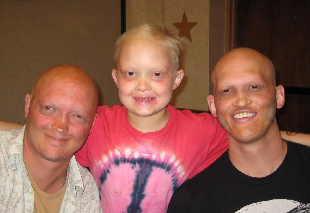 Những căn bệnh lạ hiếm gặp biến người thường thành siêu anh hùng ngoài đời thực khiến ai cũng phải khiếp sợ - Ảnh 4.