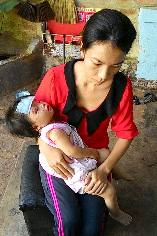 Bé bị cào đầy mặt ở nhà trẻ Họa Mi: Do bạn cắn hay bị bạo hành? - ảnh 2