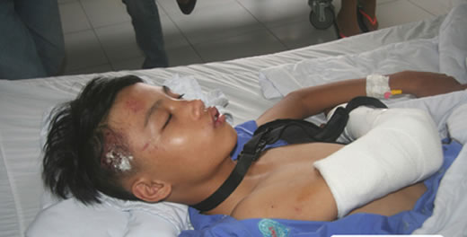 Vô cớ bị chém gần đứt lìa cánh tay - ảnh 1