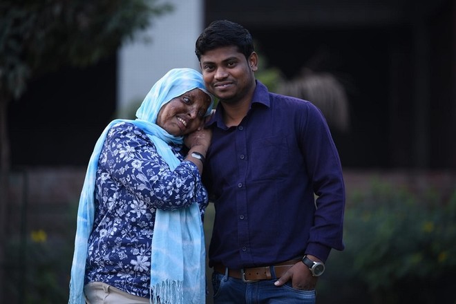 Cô gái mù lòa vì bị tạt axit chuẩn bị kết hôn với chàng trai chăm sóc cô suốt 5 năm - 6