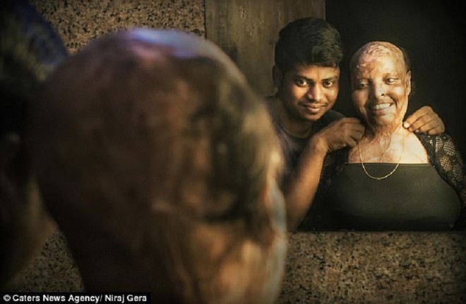 Cô gái mù lòa vì bị tạt axit chuẩn bị kết hôn với chàng trai chăm sóc cô suốt 5 năm - 2