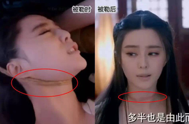 Vết cứa trên cổ Phạm Băng Băng như