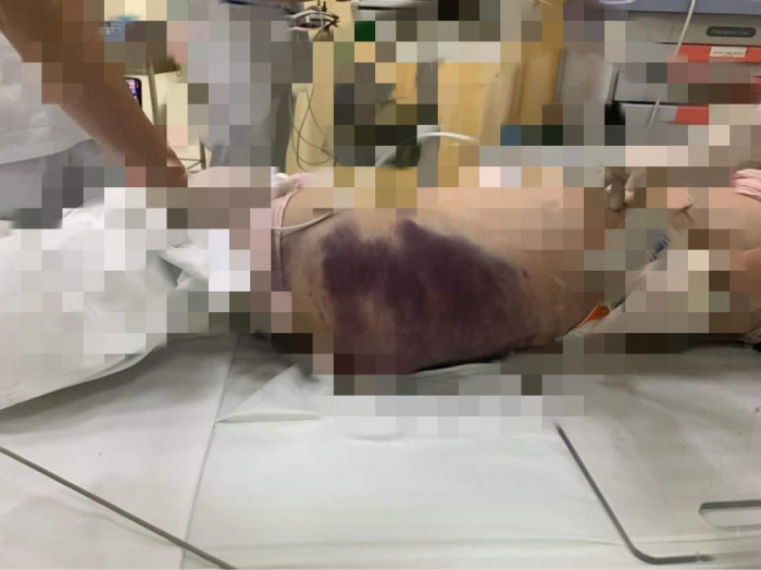 Vụ bé gái 8 tuổi tử vong nghi bị bạo hành: Xót xa lời nói cuối cùng với mẹ 2