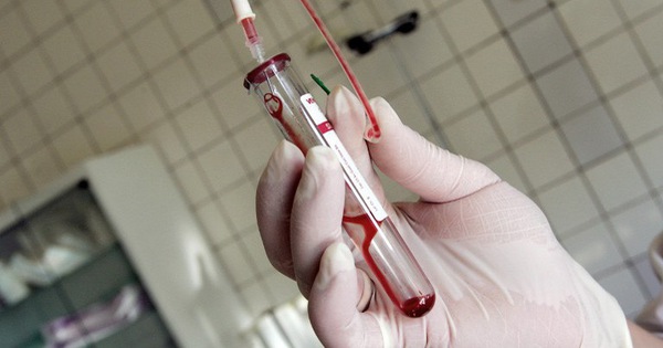 Nghe VietNamNet: Phát hiện thêm chủng HIV mới