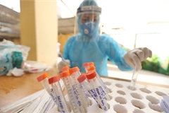 Daily COVID-19 count climbs to 8,624 as over 4,560 infections discovered