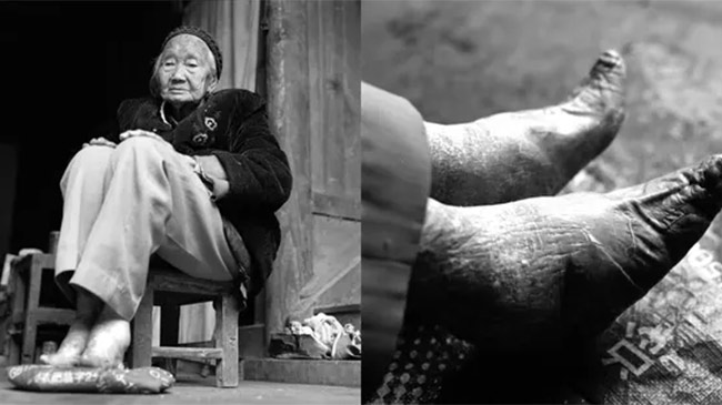 Ký ức bó chân kinh hoàng qua lời kể của cụ bà trăm tuổi có đôi chân 8cm