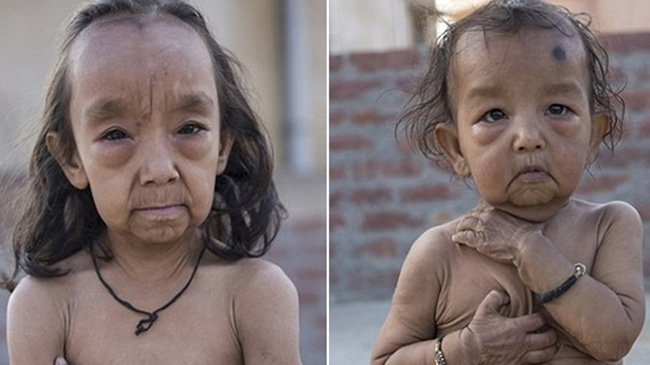 Cuộc sống của những đứa trẻ trông già hơn cả cha mẹ