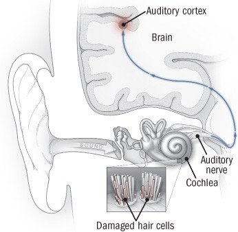 illustration-of-ear-and-auditory-pathway-to-brain.jpg