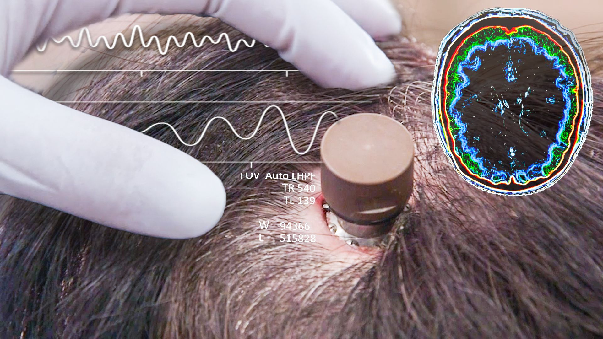 wired_wired-news-and-science-the-science-behind-elon-musks-neuralink-brain-chip.jpg