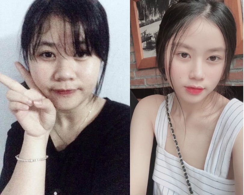 3 tháng giảm gần 30kg, nữ sinh phủ nhận “lột xác” nhờ dao kéo - 1