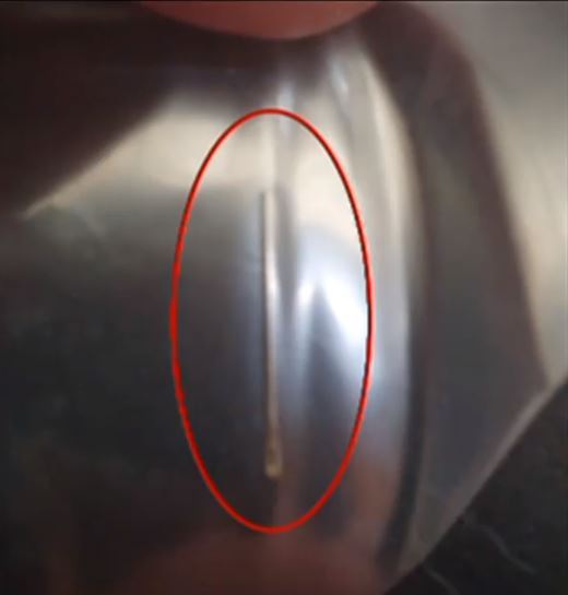 Cô bé 14 tuổi nhập viện vì nuốt phải kim trong táo mua siêu thị - 2