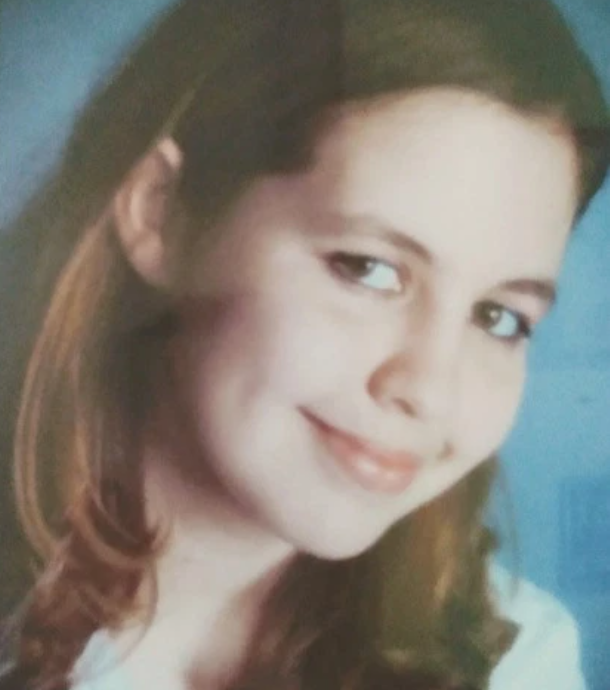 Tình yêu đầy phép màu của cô gái bị bỏng gần 80% cơ thể - 3