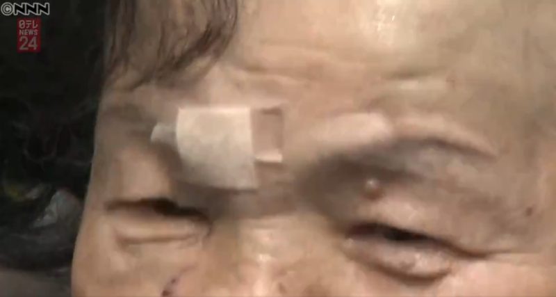 Cụ bà 82 tuổi tay không đánh thắng gấu ở vườn nhà - 3