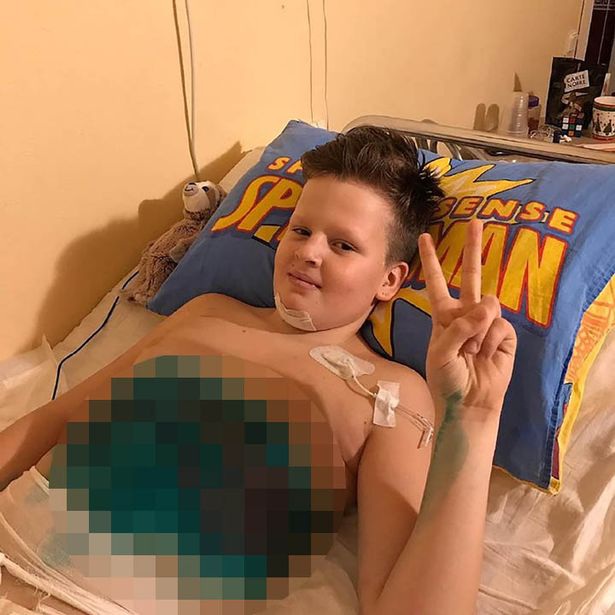 Quay video để sống ảo trên mạng, cậu bé bị tàu cán nát cả hai chân - 1