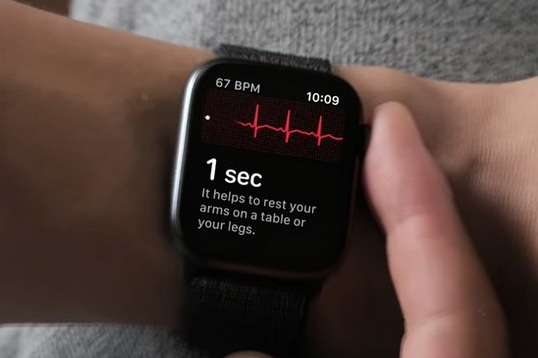 Smartwatch sẽ có thể theo dõi mức đường huyết mà không cần lấy máu - 2