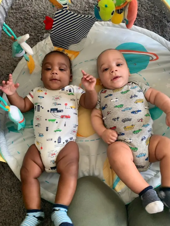 Kỳ lạ cặp sinh đôi một da đen, một da trắng - 2