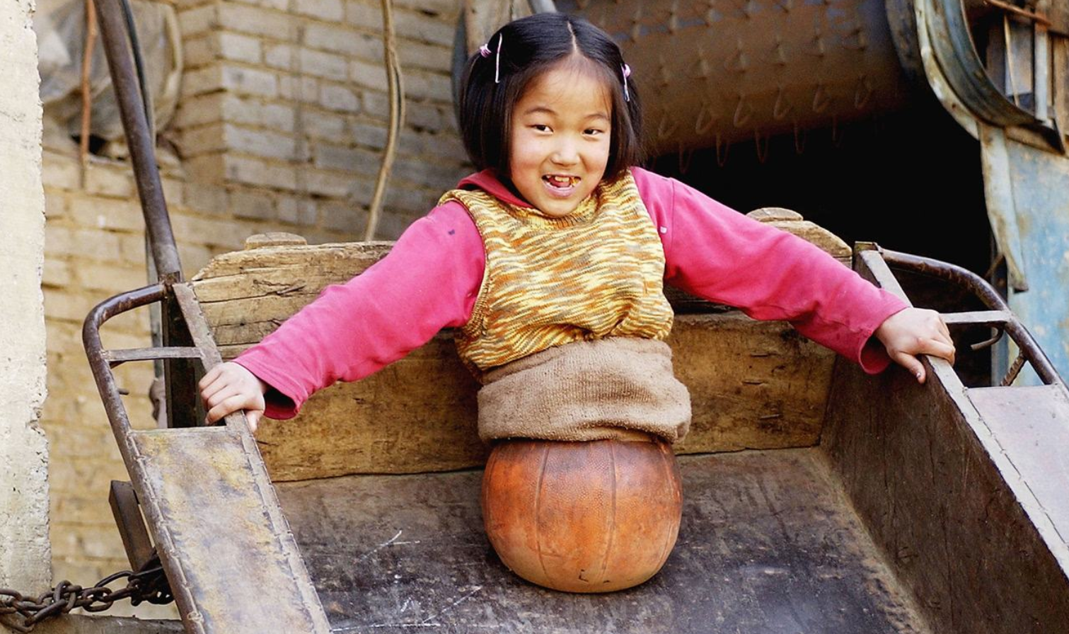 Cô bé bóng rổ mất nửa người, 14 năm sau tạo kỳ tích khiến ai cũng bất ngờ - 1