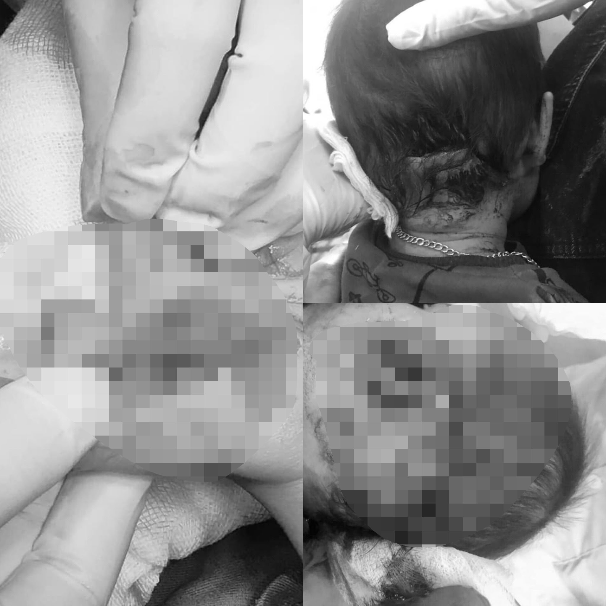 Kinh hoàng chó dữ lao vào tấn công bé trai 2 tuổi ở Tuyên Quang - 1