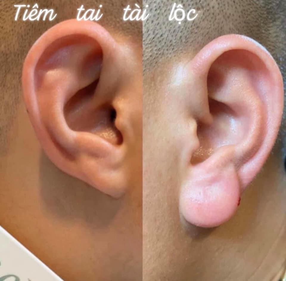 Lỗ Tai Phật: Tìm Hiểu Ý Nghĩa Và Ứng Dụng Trong Cuộc Sống