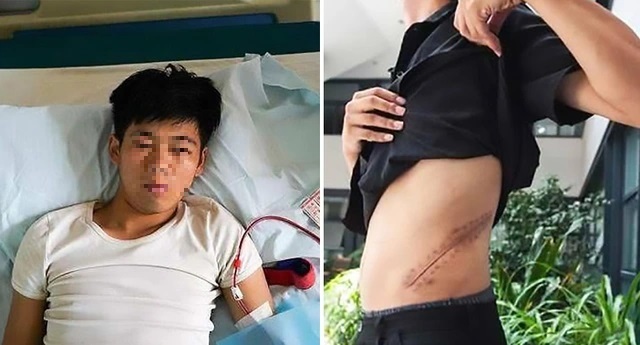 Vương Thượng Côn phải nằm liệt giường vì vết mổ sau khi anh bán thận của mình (phải) bị nhiễm trùng (Ảnh: Sohu).