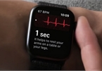 Smartwatch sẽ có thể theo dõi mức đường huyết mà không cần lấy máu