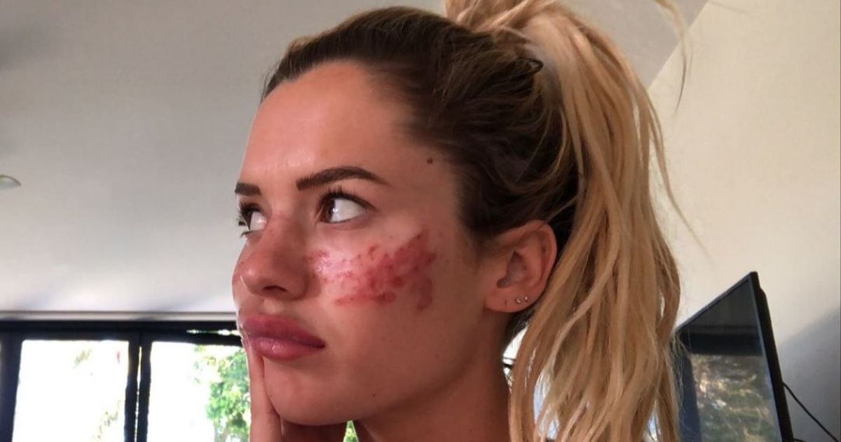 Cô gái xinh đẹp bị