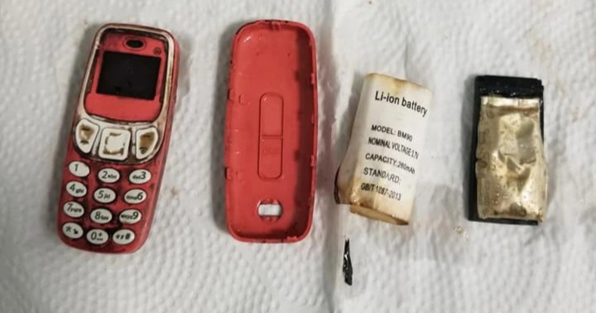 Hy hữu người đàn ông nuốt cả chiếc điện thoại di động vào bụng