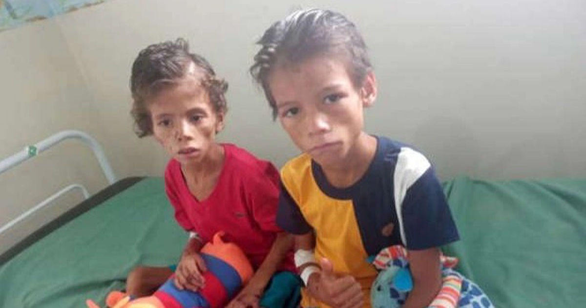 Two boys miraculously survived after 4 weeks lost in the jungle