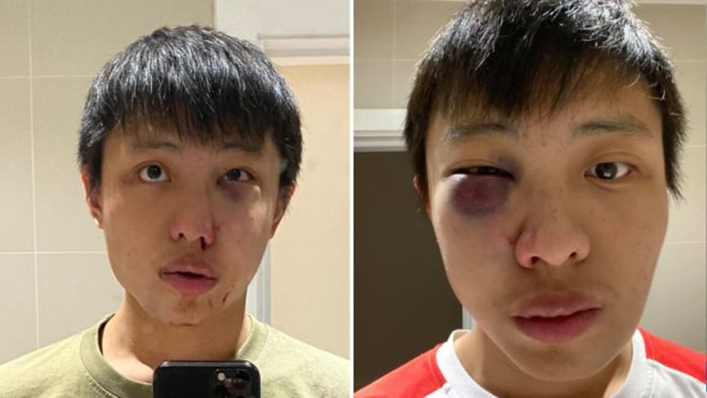 Coronavirus: Student from Singapore hurt in Oxford Street attack