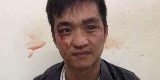 Nghe VietNamNet: Bắt nam thanh niên cướp tiệm vàng ở Hà Nội