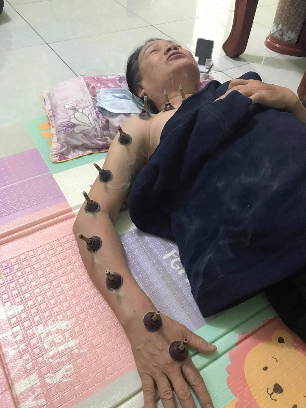 K phổi của mẹ vợ đã ở giai đoạn cuối, u đã bưng mủ không thể can thiệp bằng phẫu thuật, chàng rể không đầu hàng mà tự mình mày mò các biện pháp trị liệu để giúp bà có sức đề kháng tốt hơn (Ảnh nhân vật cung cấp)