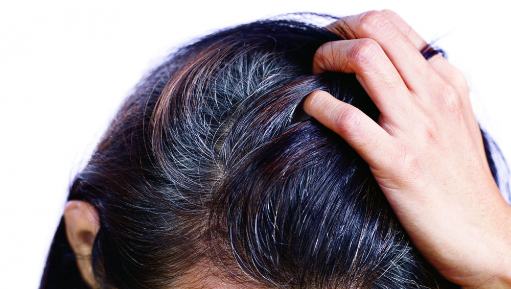 Học lỏm 7 bài thuốc nam điều trị rụng tóc hiệu quả nào  Đẹp365