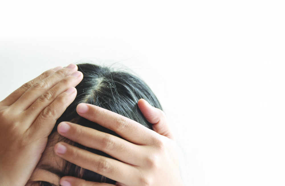 Để nhuộm tóc ở nhà an toàn, nên lựa loại thuốc một pha và tránh để thuốc nhuộm dính vào mắt