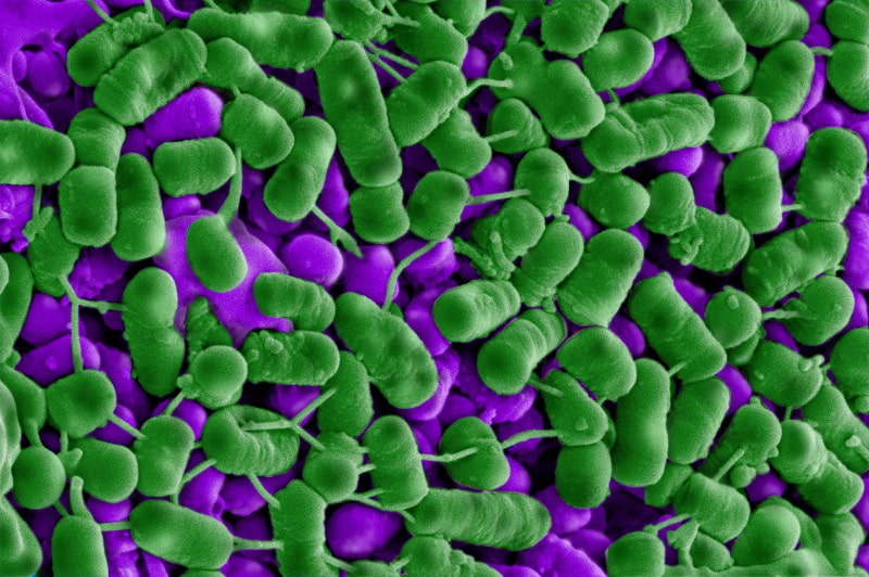 Vi khuẩn Listeria (màu xanh lá) chết dần sau khi tiếp xúc với Plantacyclin B21AG. Các khối gồ ghề trên bề mặt nhiều tế bào là do chất trong tế bào đang bị rò rỉ ra ngoài - Ảnh: Elvina Parlindungan/RMIT University