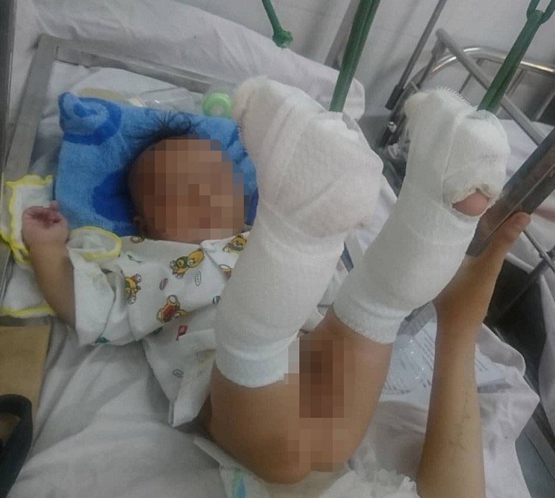 Khởi tố người cha đánh con 4 tháng tuổi ở quận 9 - ảnh 2
