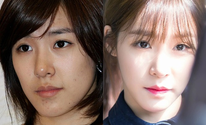 Sốc với hình ảnh làn da của các idol bị tàn phá do phải trang điểm quá nhiều - ảnh 7