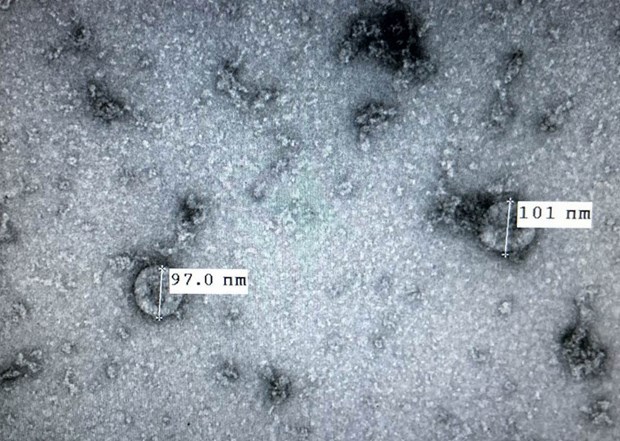 Virus divided into two different groups: Vietnamese scientists