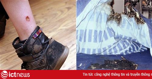 BlackBerry Curve 9320 bốc cháy trên giường