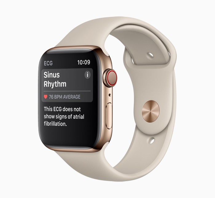 Apple Watch khiến các phòng cấp cứu bận rộn không cần thiết?