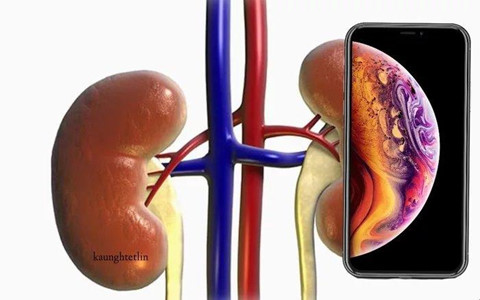 Lam iPhone qua tot, Apple dang tu dau voi chinh minh hinh anh 4