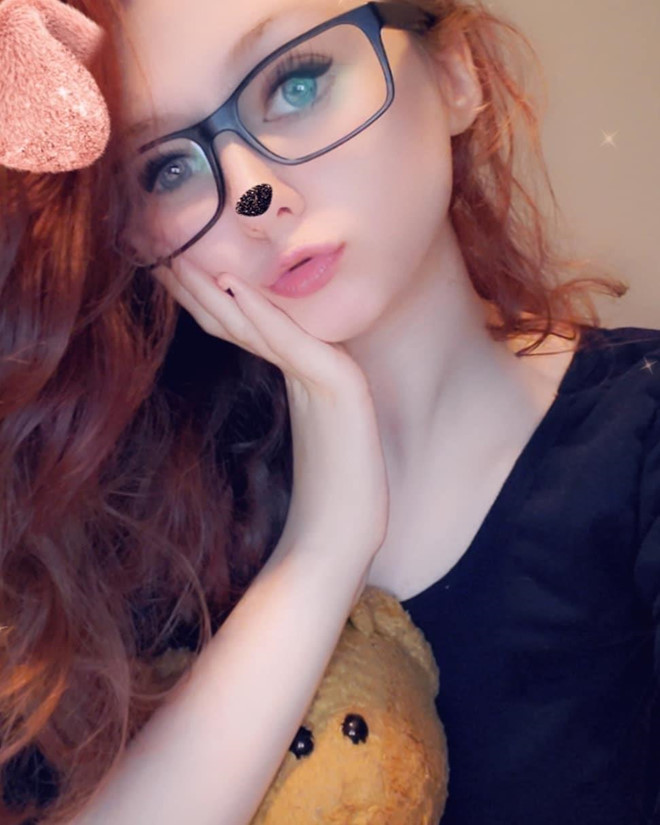 Nguoi tre do xo di phau thuat de giong anh 'song ao' tren mang xa hoi hinh anh 2