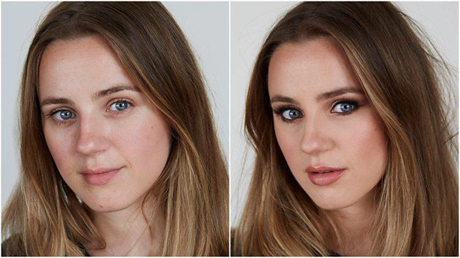 Nguoi tre do xo di phau thuat de giong anh 'song ao' tren mang xa hoi hinh anh 1