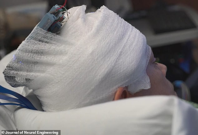 Bạn có thể nâng cấp trí nhớ của mình bằng cách cấy một con chip vào não bộ - Ảnh 3.