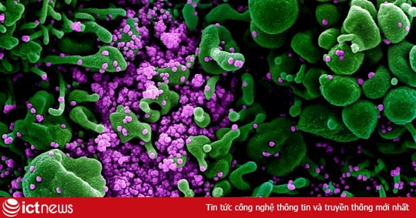 Ảnh chụp nCoV đang “giết chết” tế bào con người