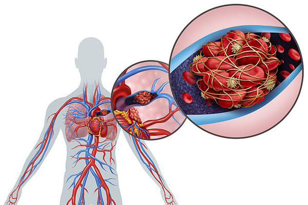 Không chỉ ‘thích’ phổi, virus corona mới còn tấn công hàng loạt nội tạng