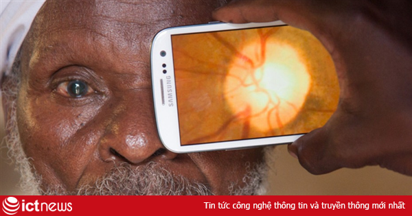 Ứng dụng khám mắt trên điện thoại smartphone