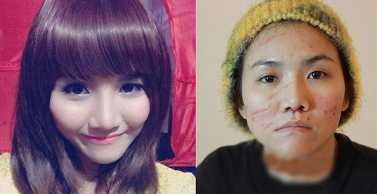 Theo phản ánh, Anh Thúy thậm chi đã đăng ảnh mặt lành lặn từ xưa dù hiện tại mặt đầy vết sẹo, ý định đánh lạc hướng dư luận.